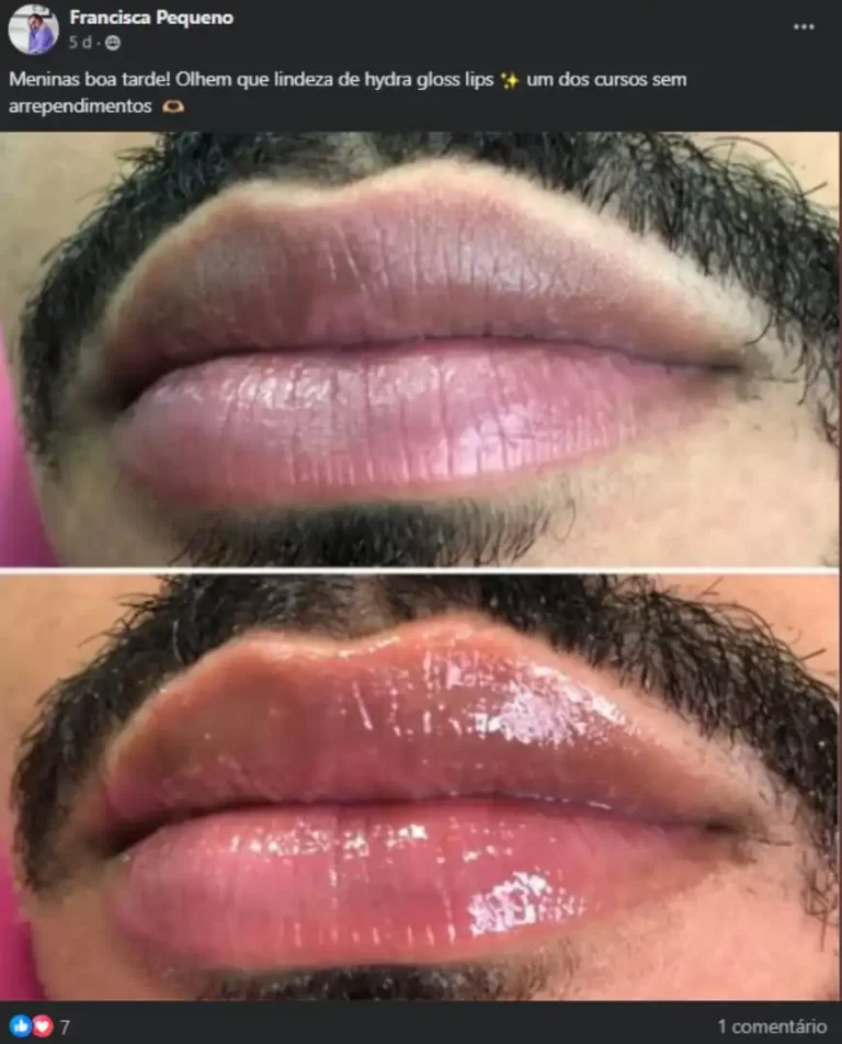 hidraglosslips-homens.png