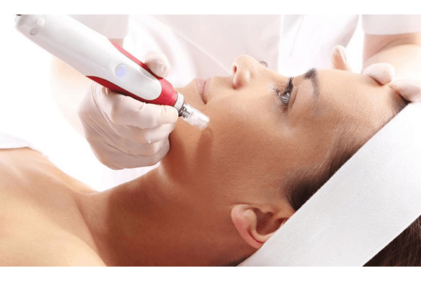 Microagulhamento facial dermapen