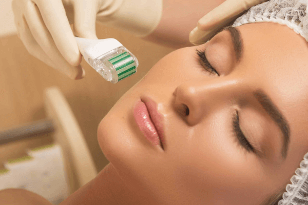 Microagulhamento facial curso online