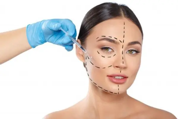 Aplicação de toxina botulínica para harmonização facial