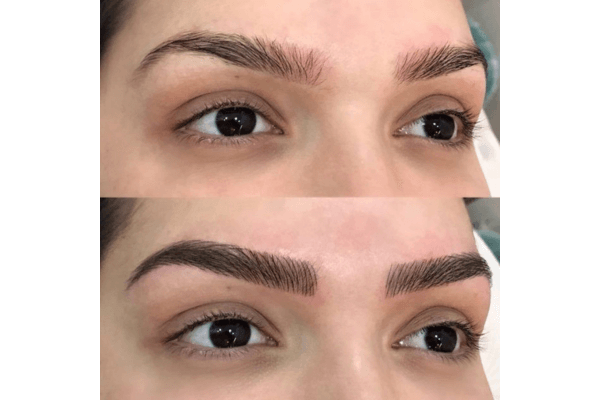 Antes e depois do microblading nas sobrancelhas, transformação natural e bem definida.