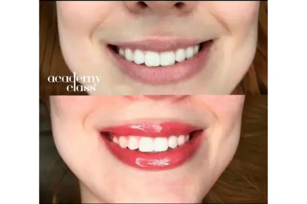 Micropigmentação Labial Antes e Depois