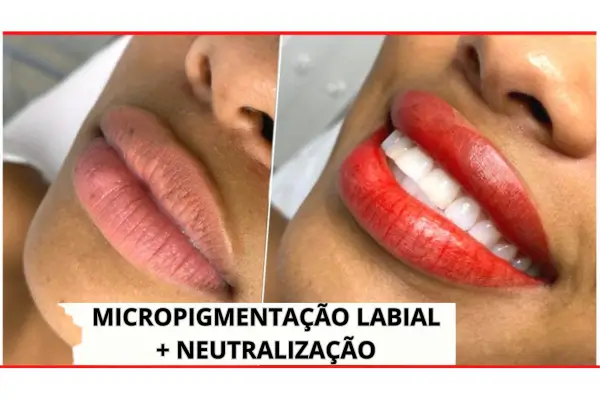 Micropigmentação para Lábios Escuros